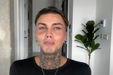 TikTok star Levi Jed Murphy reflects on reactions to his ‘dramatic’ plastic surgeries