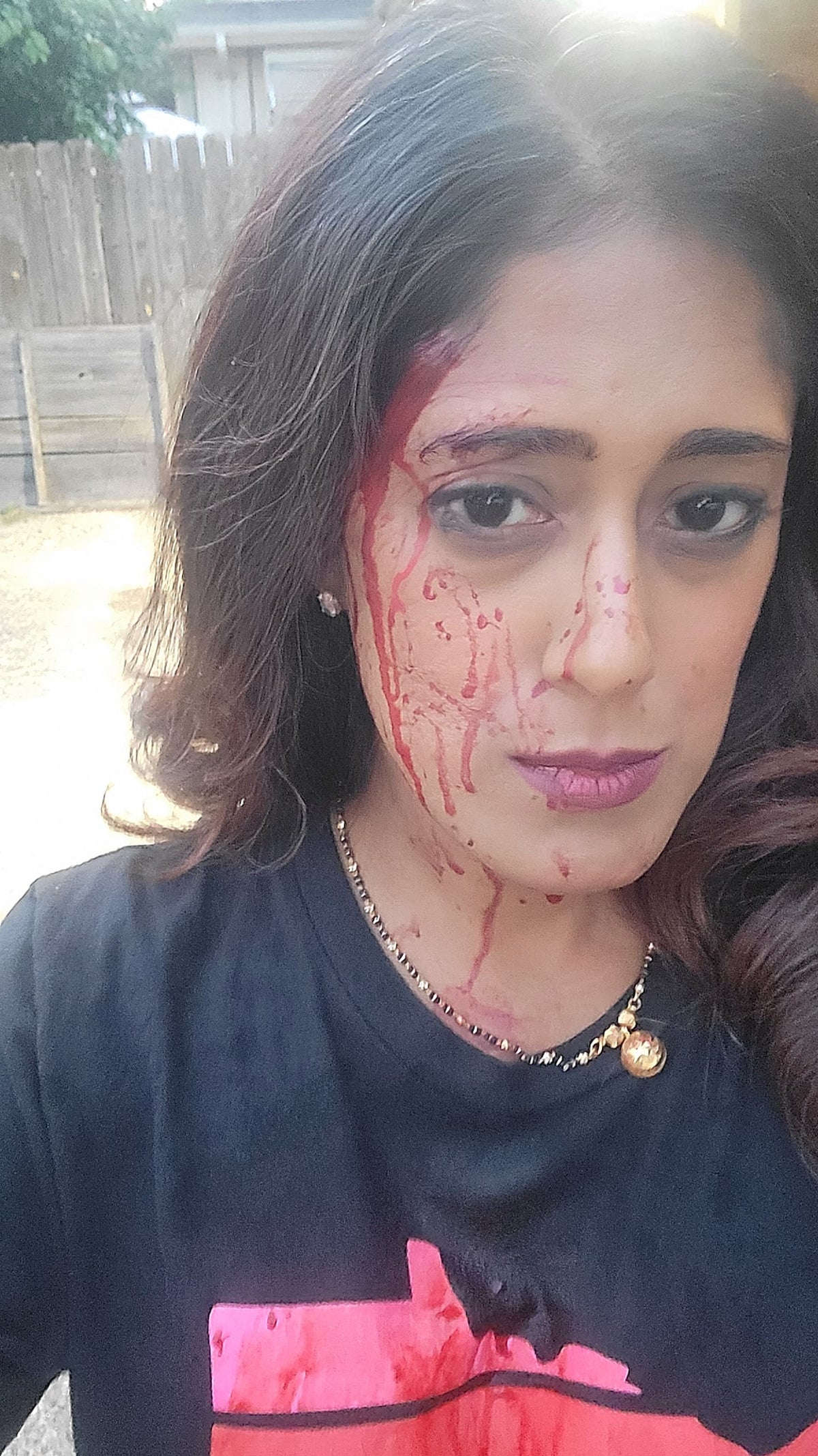 Democrat official shares bloody selfie after carjacking attack