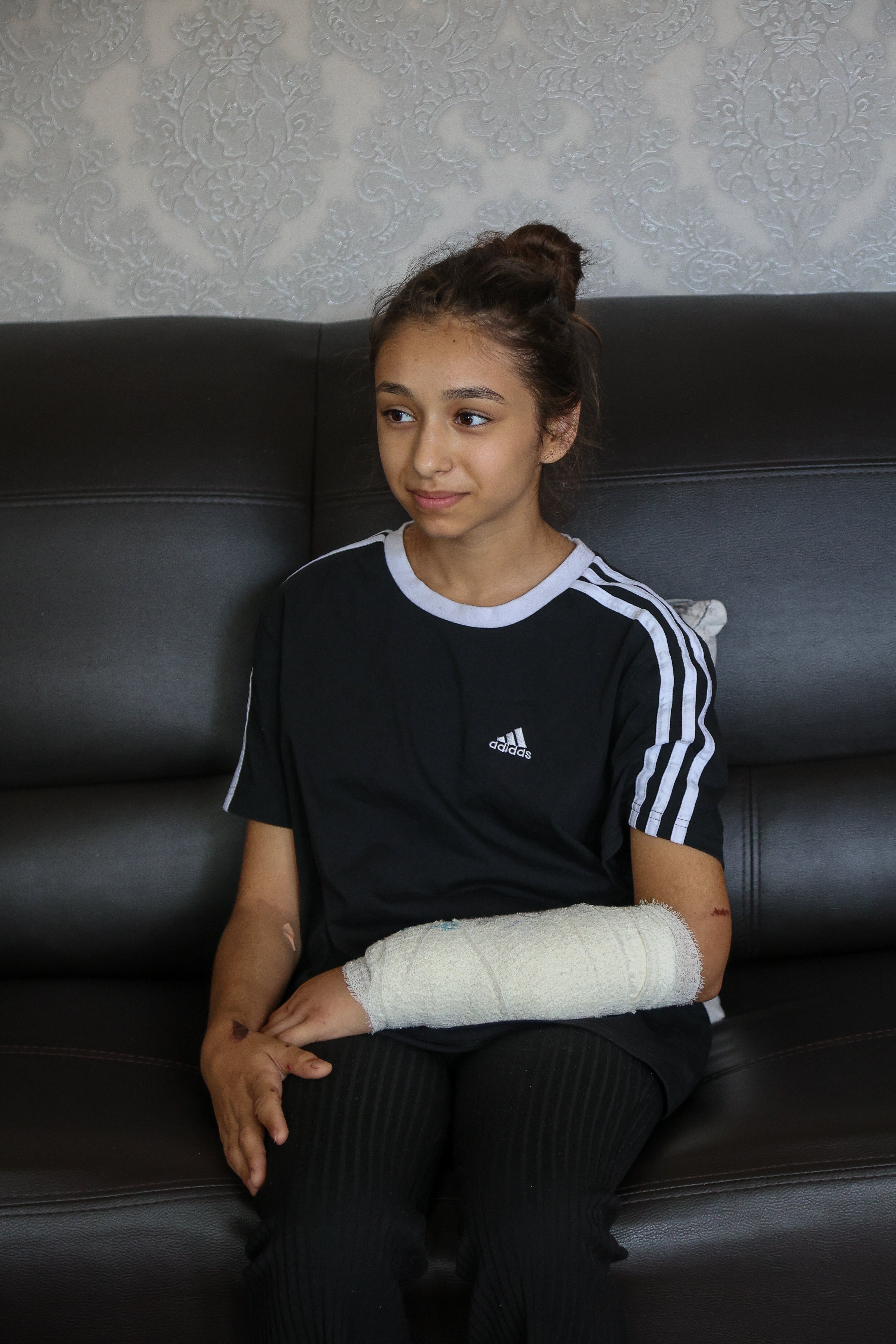 Ana Paun with her arm bandaged after being attacked by the American XL