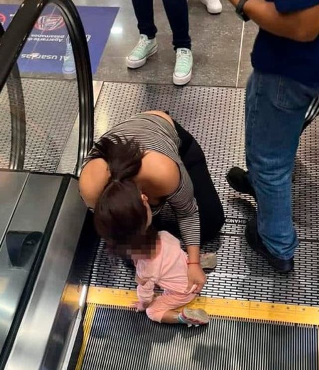 <p>The two-year-old nearly lost her fingers after trapping her hand in the jagged guard at the bottom of an escalator</p>