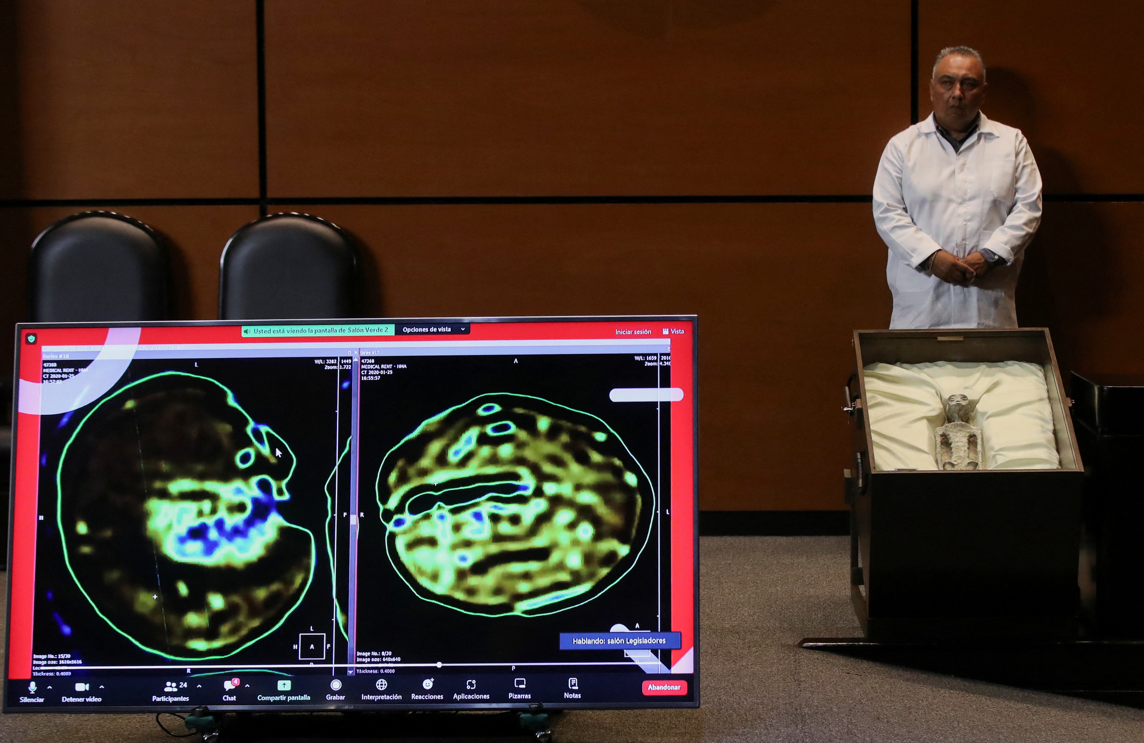 <p>X-rays of the specimens were also shown during the hearing, with experts testifying under oath that one of the bodies is seen to have “eggs” inside</p>