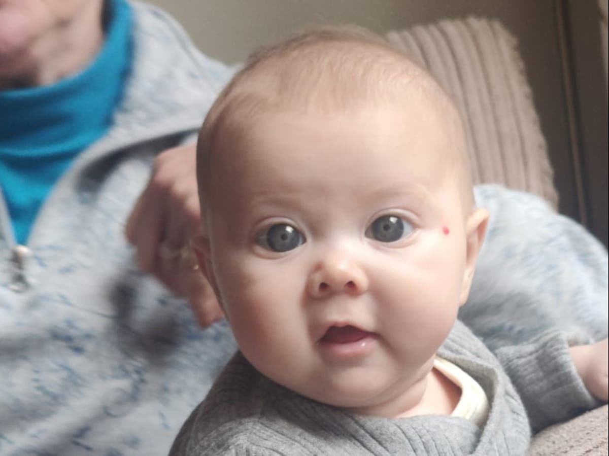 Bilateral congenital glaucoma: My baby’s beautiful blue eyes turned out to be a symptom of condition causing blindness