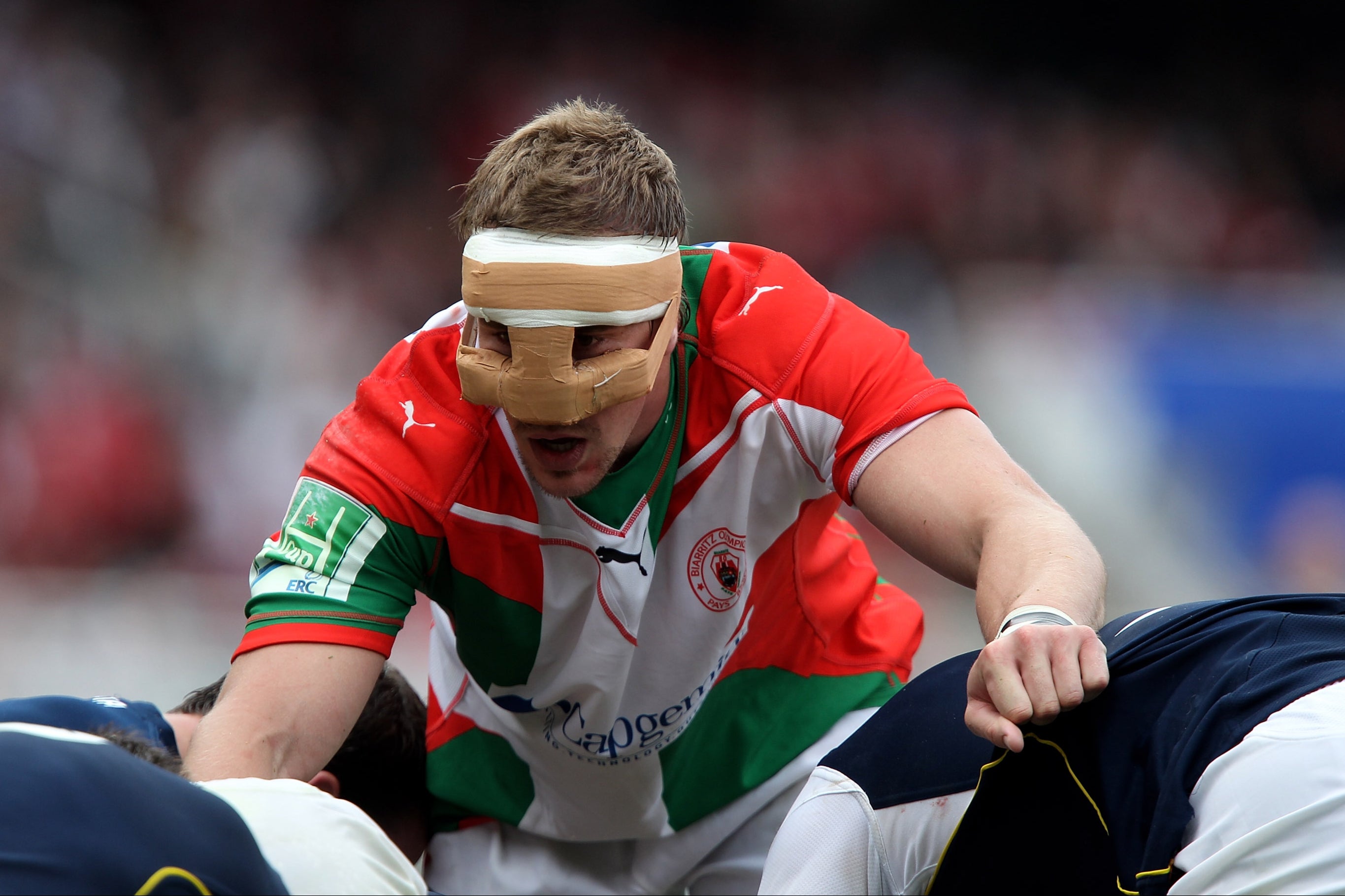 Imanol Harinordoquy wore a makeshift mask to protect a broken nose