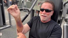 Arnold Schwarzenegger, 76, works out with badly bruised arm while recovering from surgery
