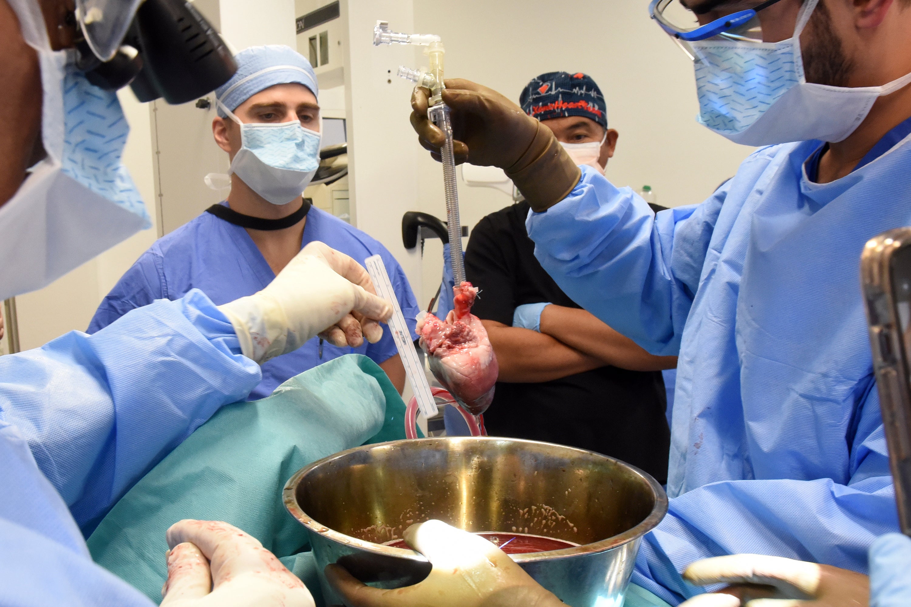 Surgeons prepare for the transplant