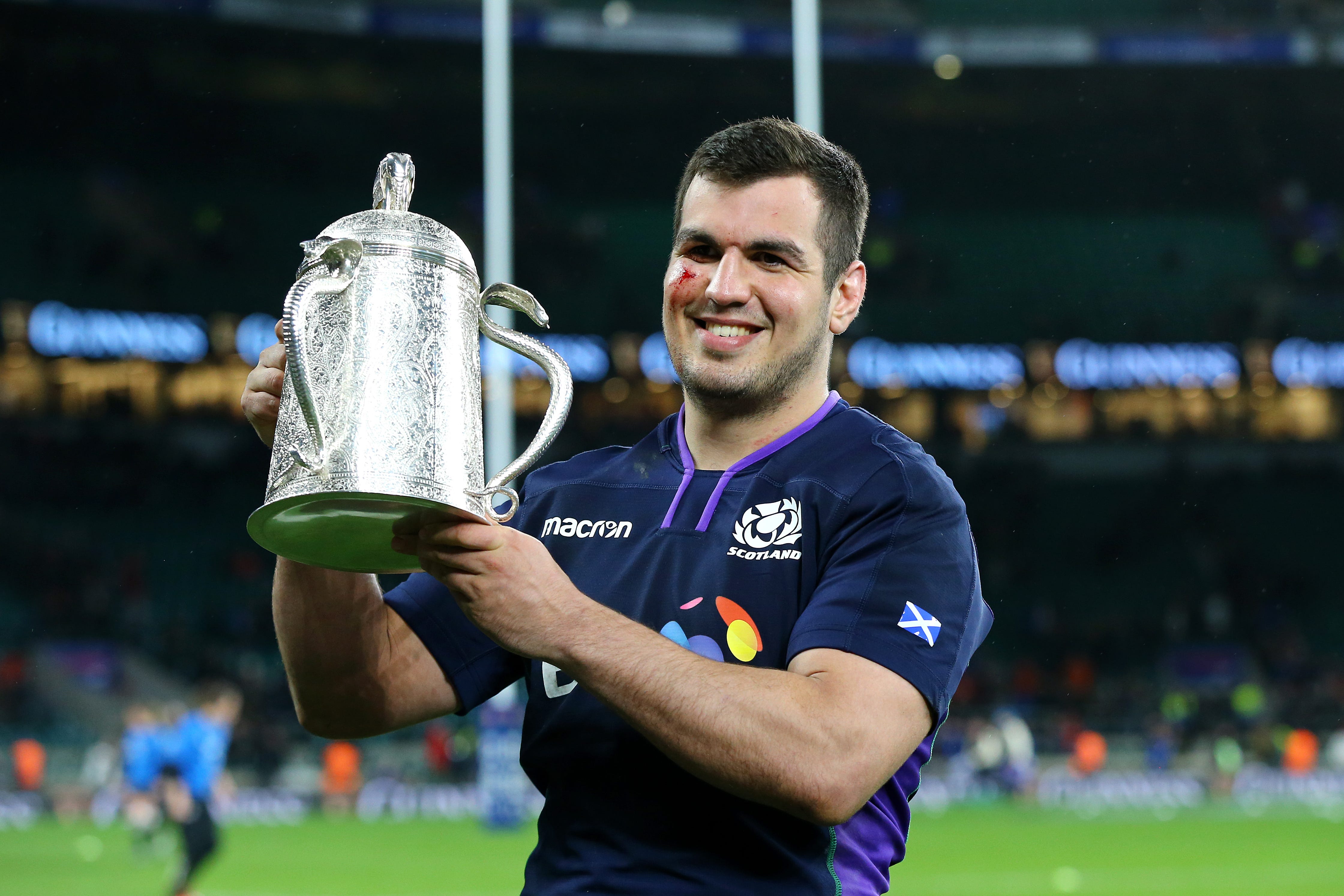 Stuart McInally’s rugby career is now over (Gareth Fuller/PA)