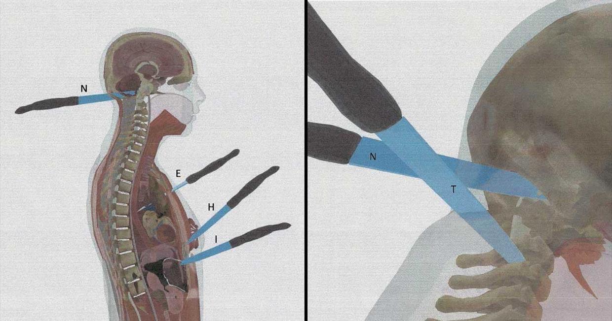 A computerized rendering shows several of Ellen Greenberg’s stab wounds
