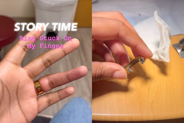 <p>Woman goes to three emergency rooms to get ring off finger but has plans to buy the same one again</p>
