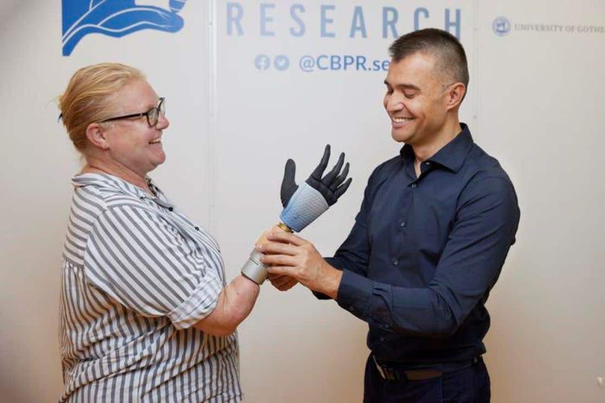 Bionic hand breakthrough could be ‘life-changing’ for amputees