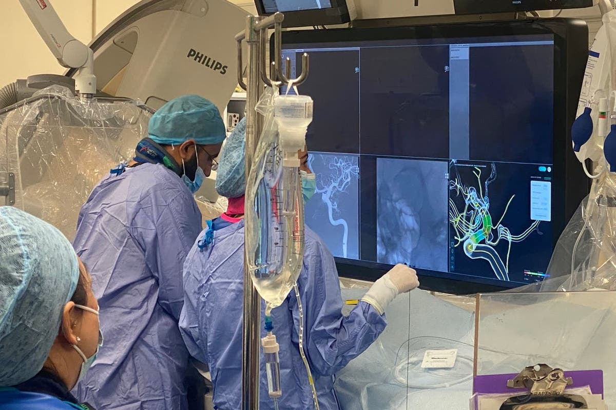 AI-driven software could revolutionise brain aneurysm treatment