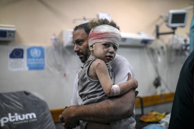 <p> An injured child is brought to the Nassr hospital after the Israeli airstrikes in Khan Yunis, Gaz</p>