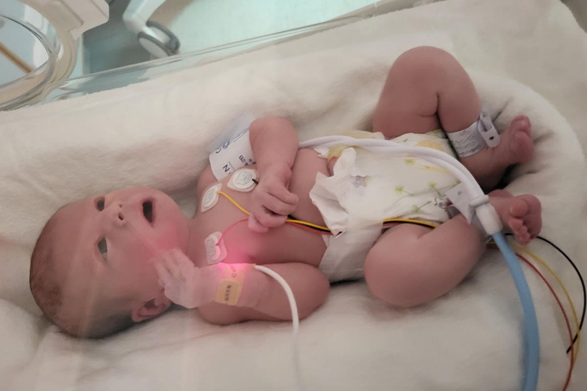 Parents of critically ill baby lose latest stage of life-support treatment fight