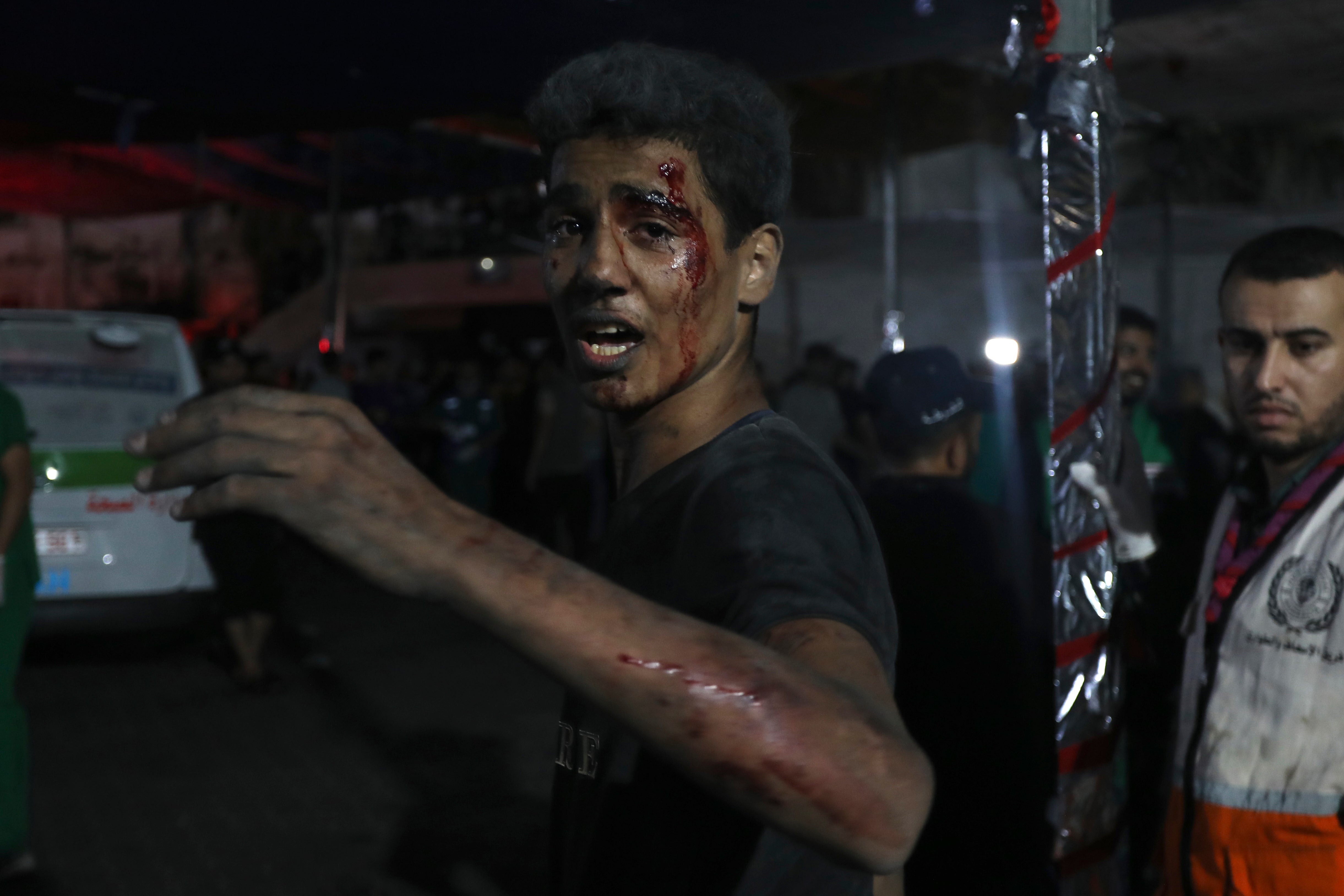 An injured Palestinian man arrives at the al Shifa hospital following Israeli airstrikes on Gaza City