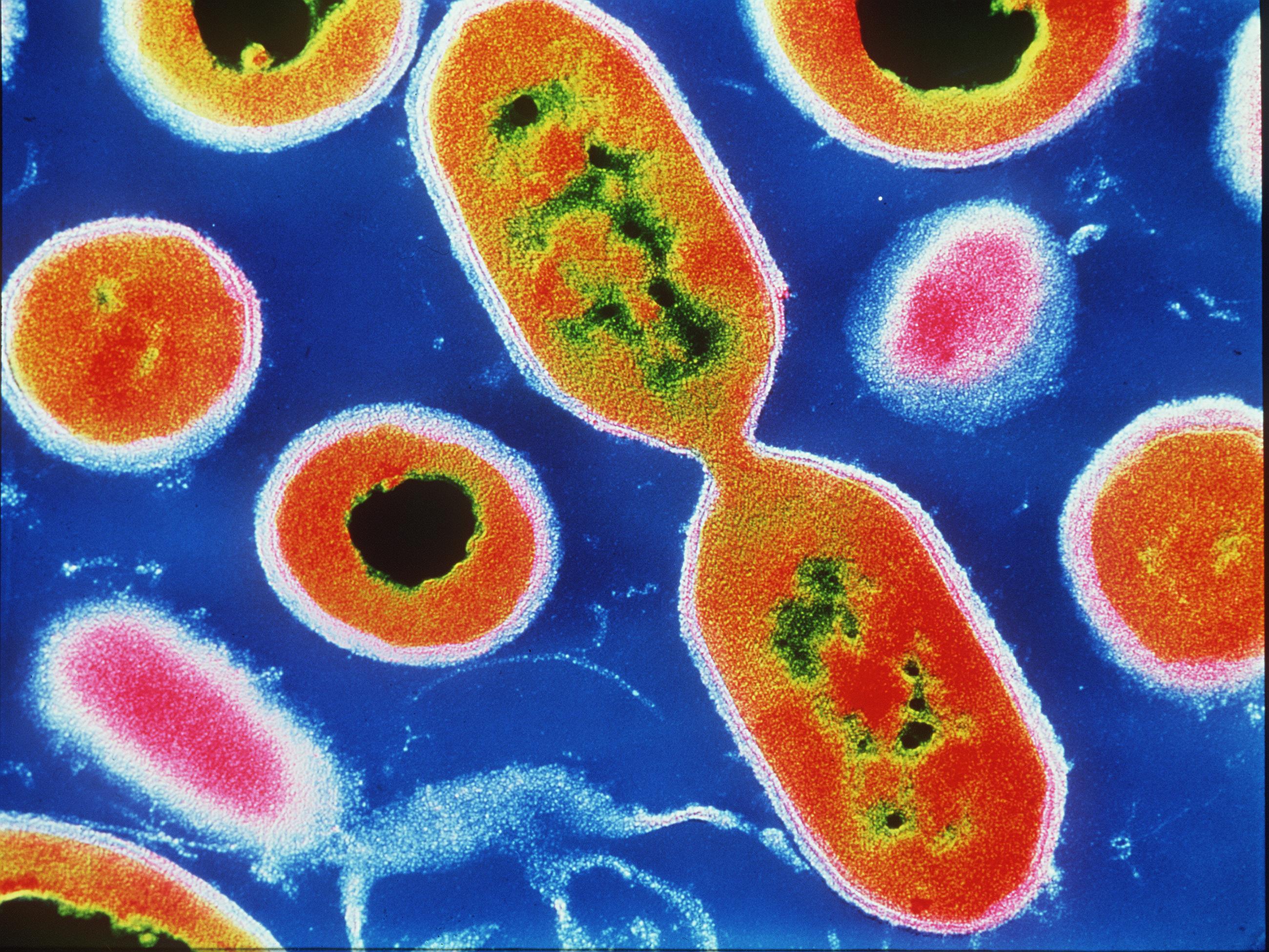 Listeria infections can be severe and even deadly for vulnerable people including those over 65
