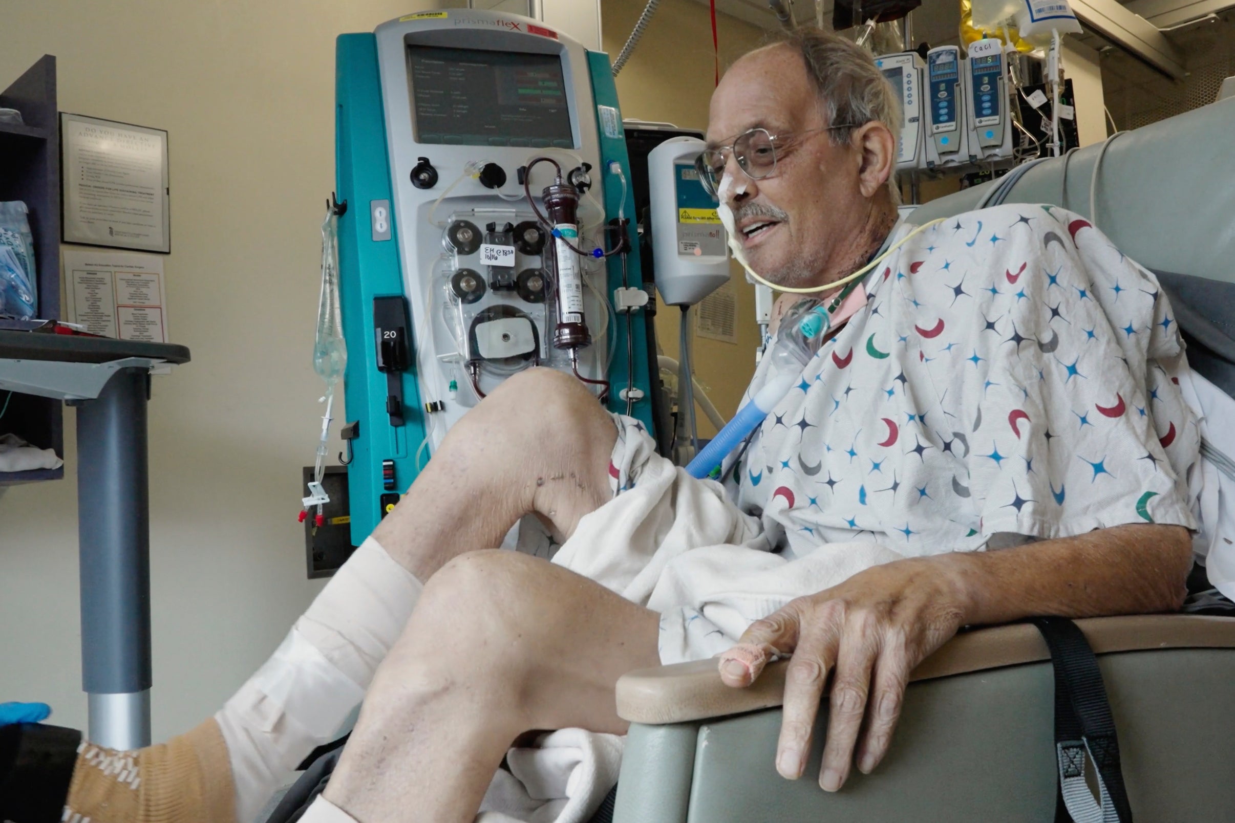 Lawrence Faucette, who recieved a pig heart transplant