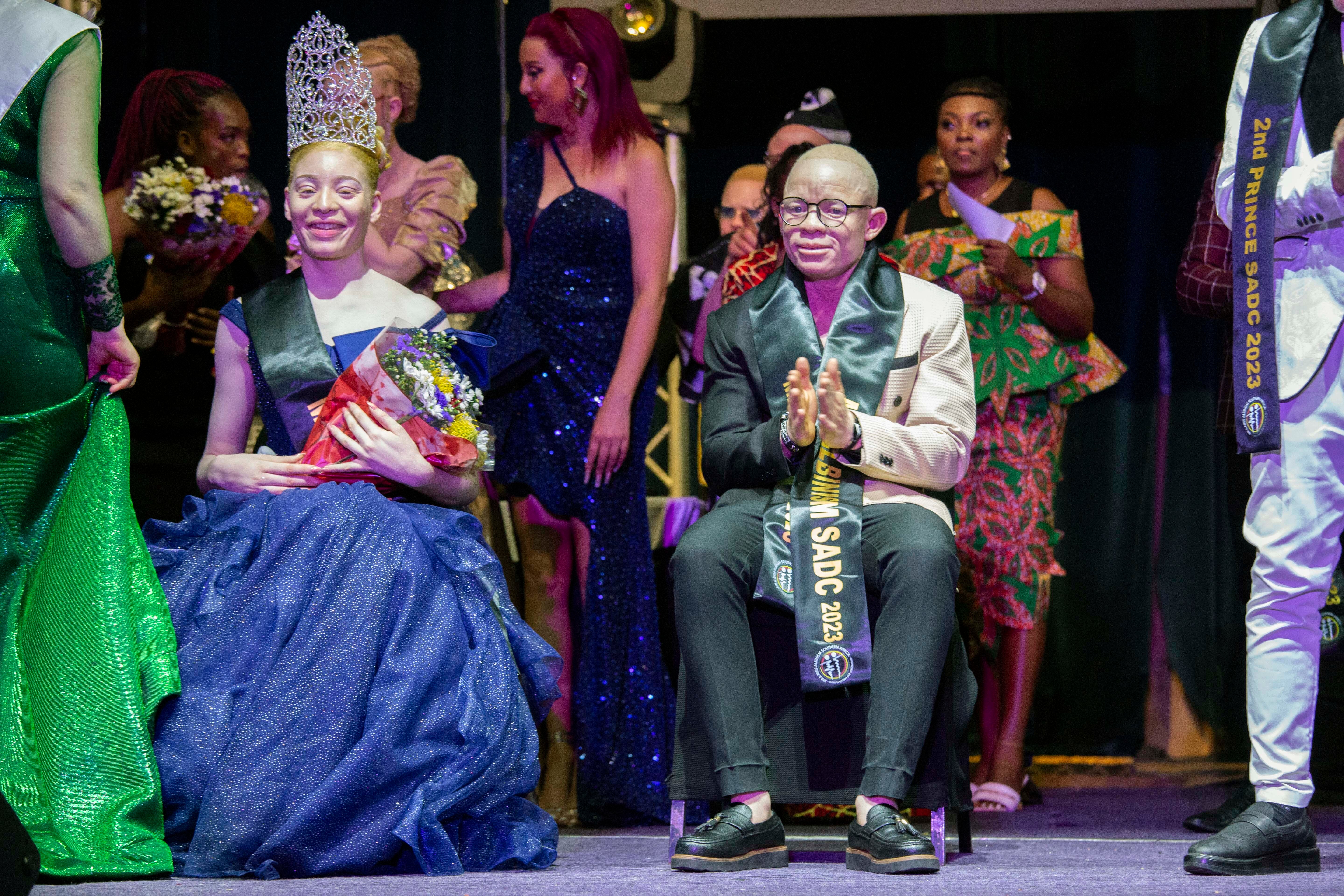 Zimbabwe Albinism Pageant
