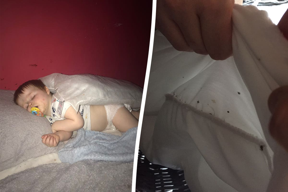 Family forced to leave council home due to horrific bedbug infestation