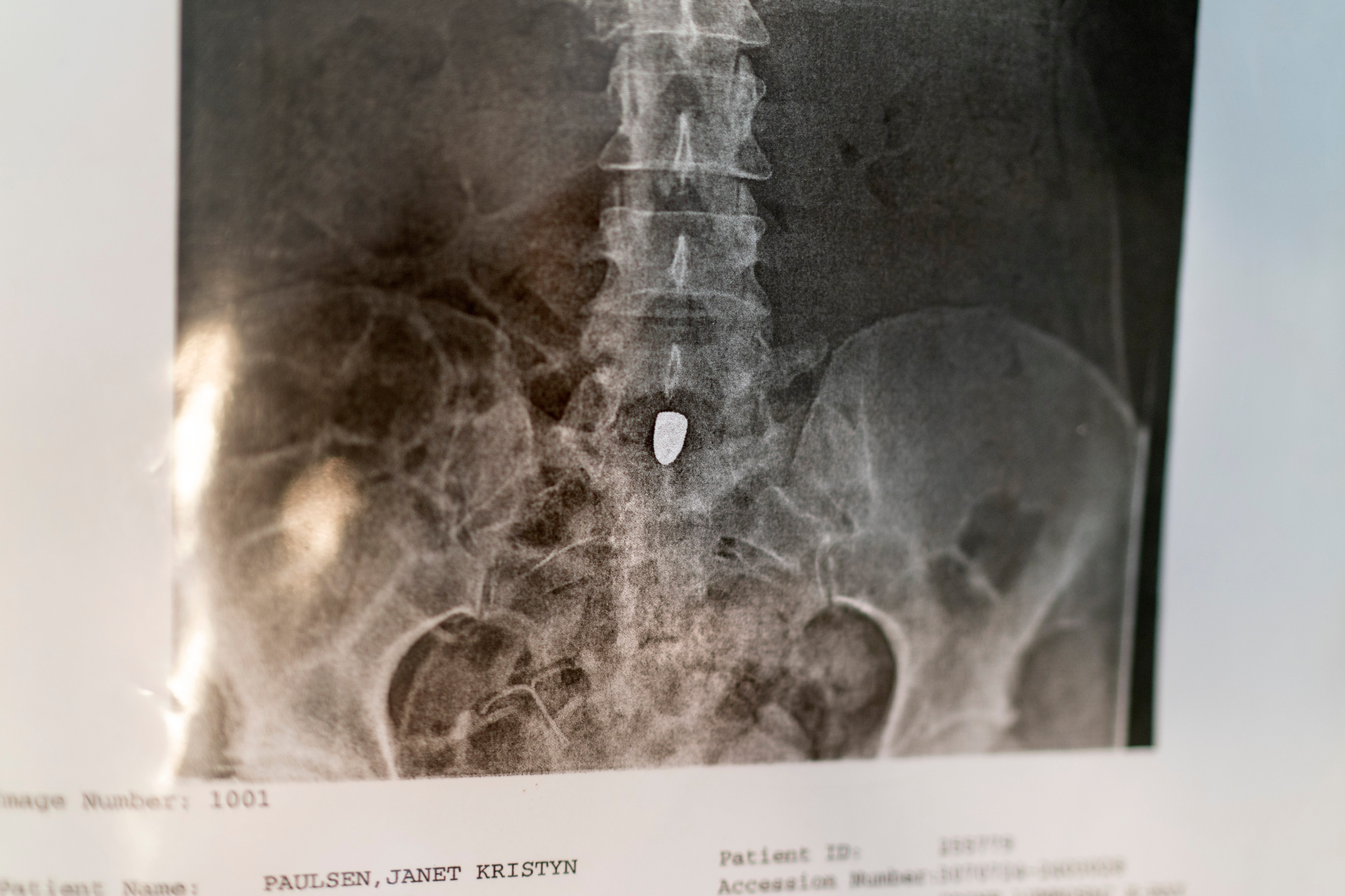 Freedom Under Fire Safety at Home