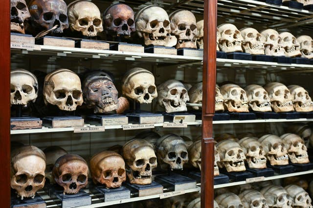 The University of Edinburgh holds one of the largest and most historically significant collections of ancestral remains (Neil Hanna/PA)