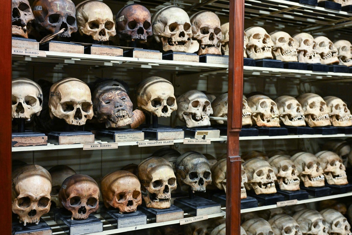 University repatriates centuries-old skulls to Japan: ‘We believe they are pleased to return home’