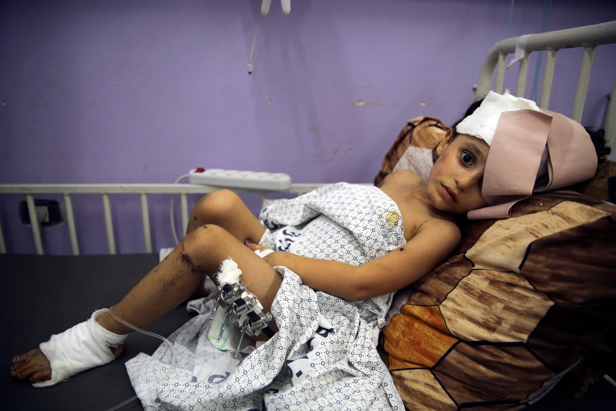 AP PHOTOS: Scenes of pain and destruction endure in week 4 of the latest Israel-Gaza conflict