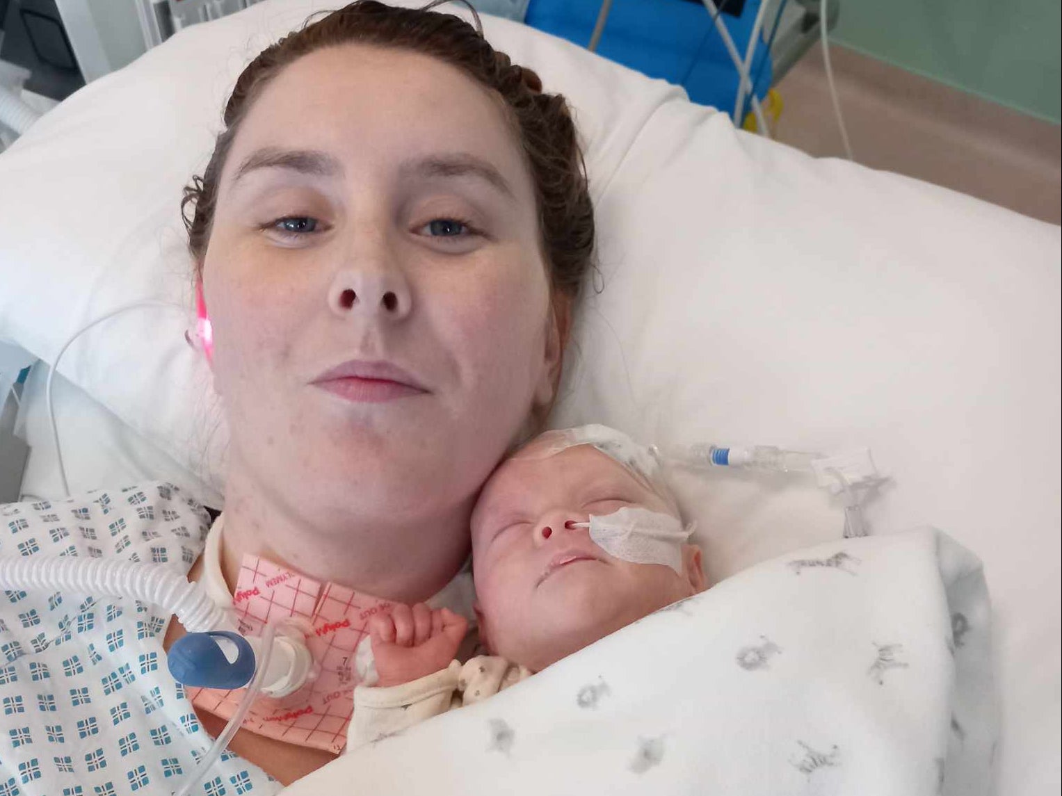 Becky Prout gave birth in a coma after suddenly starting to speak with an American accent due to a disease