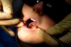 Rise in mouth cancer deaths ‘linked to shortage of NHS dentists’