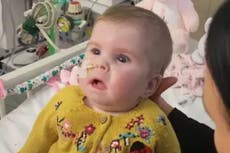 Ill baby’s parents say ‘right’ to end treatment at home has been removed