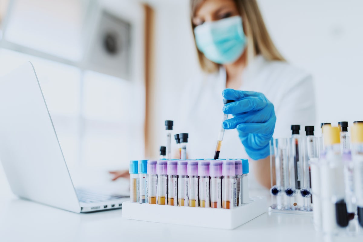 Scientists discover world’s rarest blood group, found in just one person