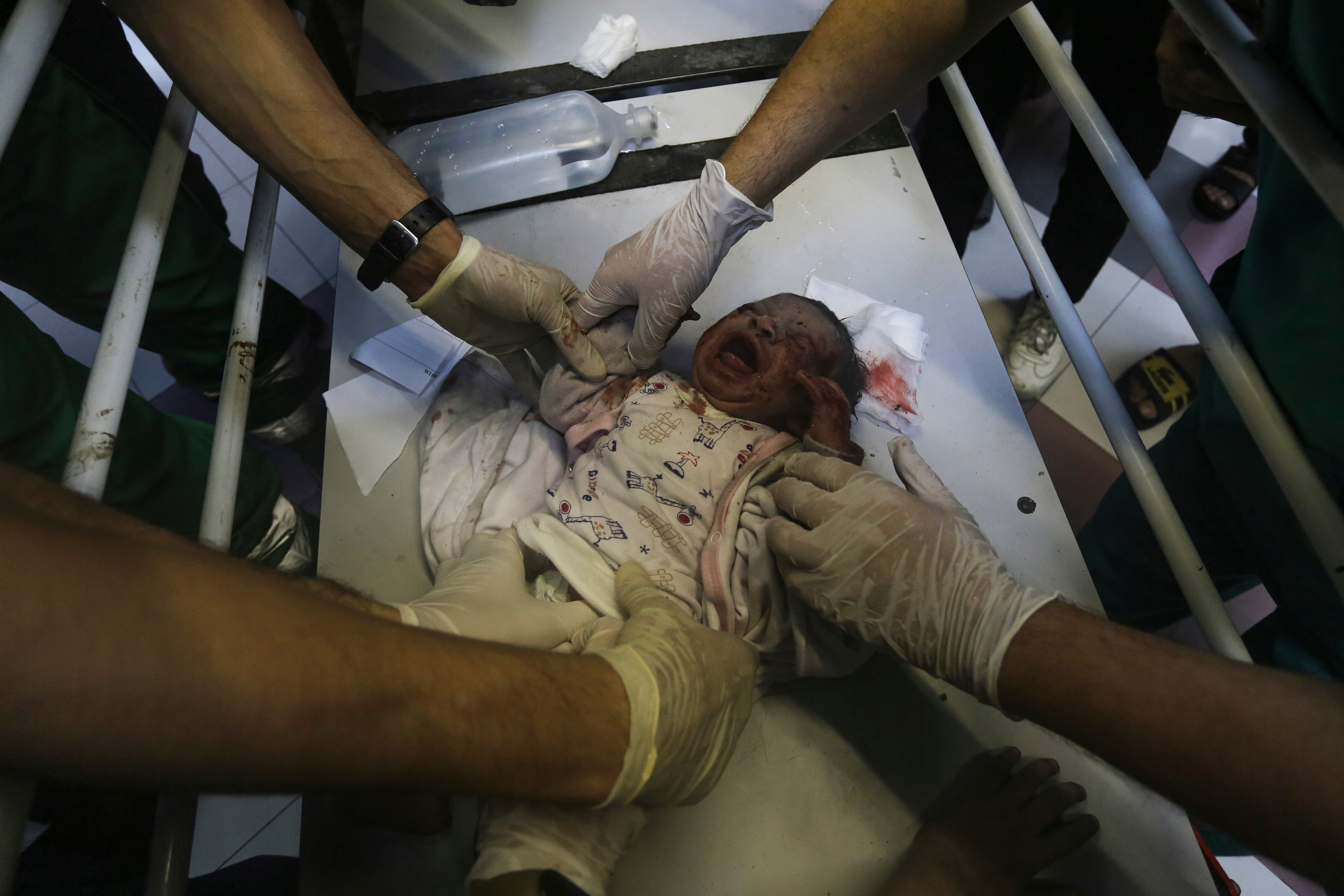A wounded baby receives care at al-Shifa