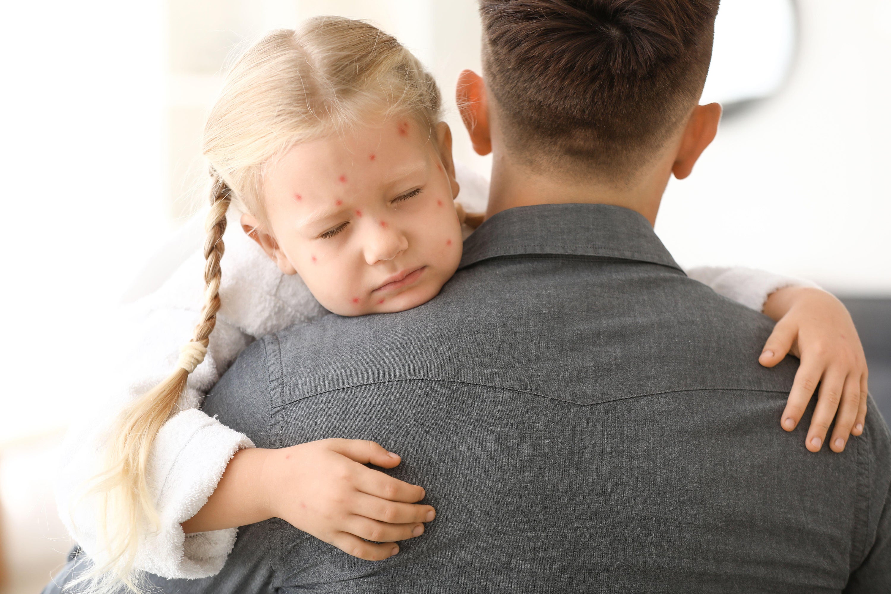 Chickenpox jab set to be added to routine childhood vaccine programme