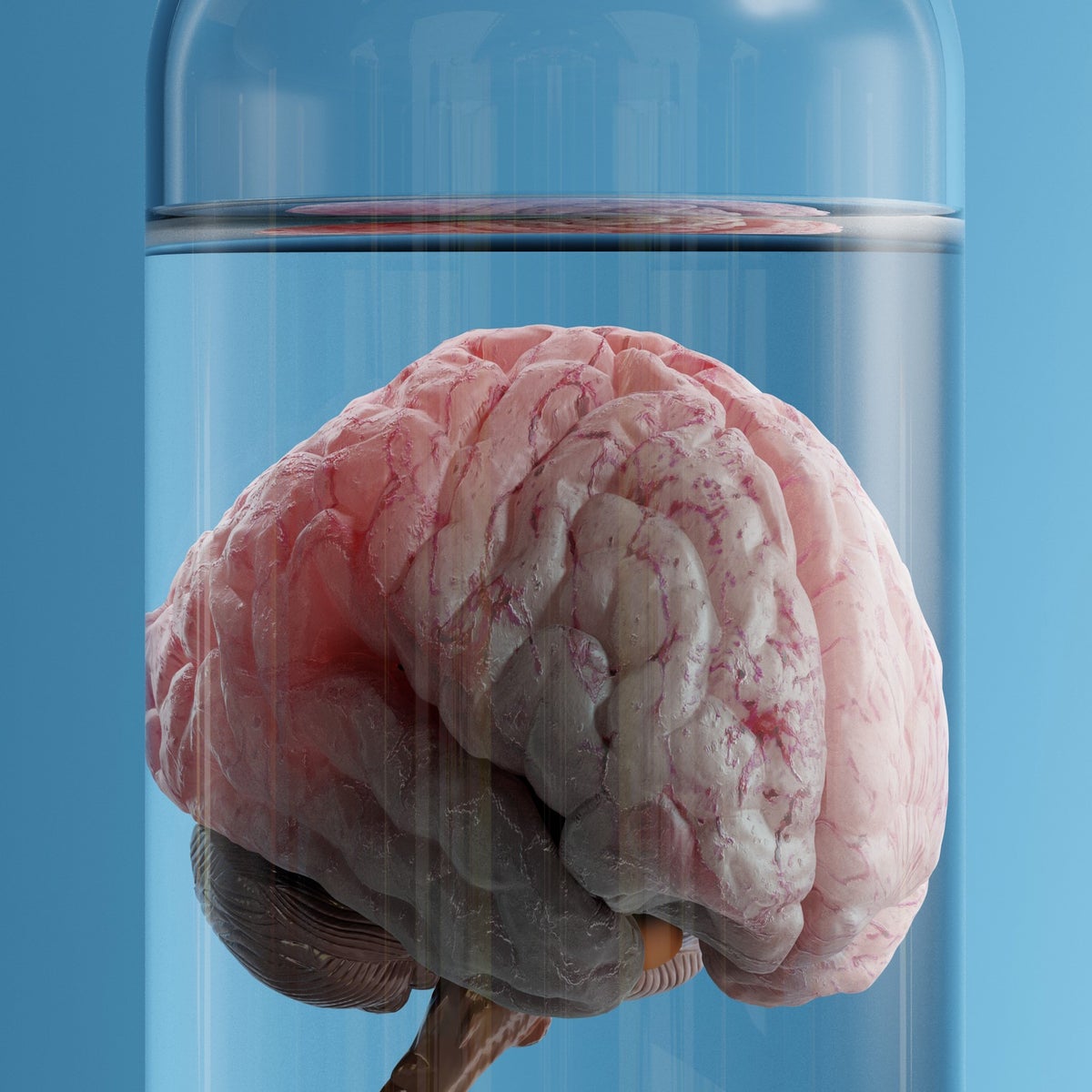 Human brain specimen. The human brain specimen that underwent ex vivo