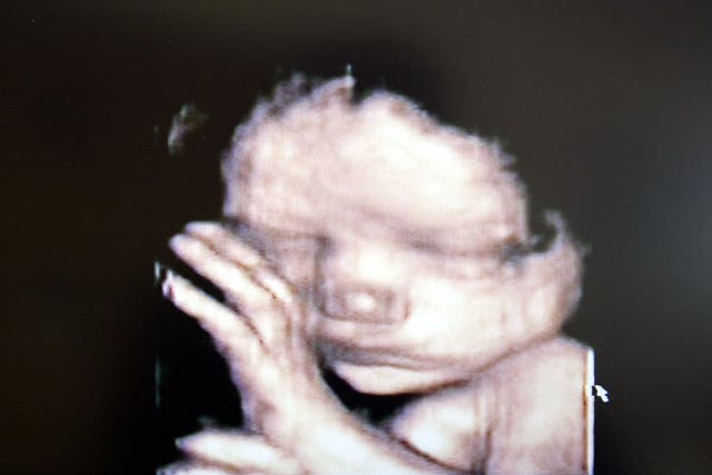 <p>Representational image of a 3D ultrasound showing a baby inside the womb</p>