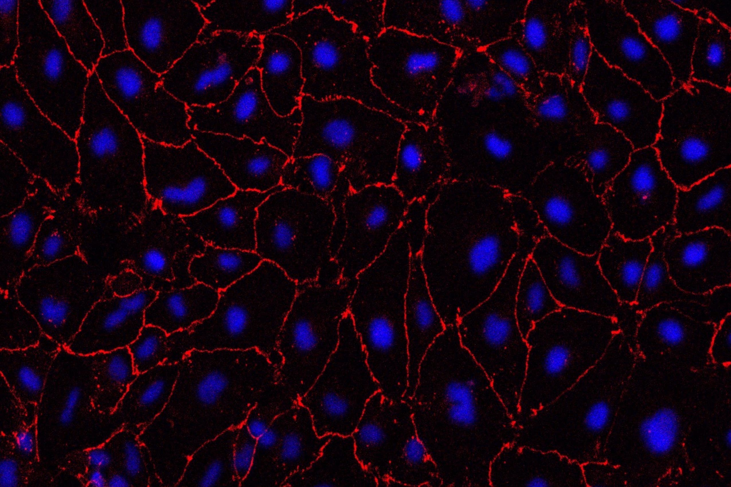 Lab-grown small blood vessels 'indicate treatment for major cause of stroke' - Vimarsana News