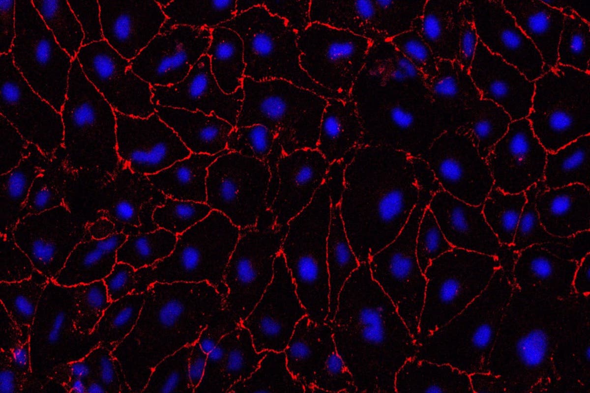 Lab-grown small blood vessels ‘indicate treatment for major cause of stroke’ Lab-grown small blood vessels ‘indicate treatment for major cause of stroke’