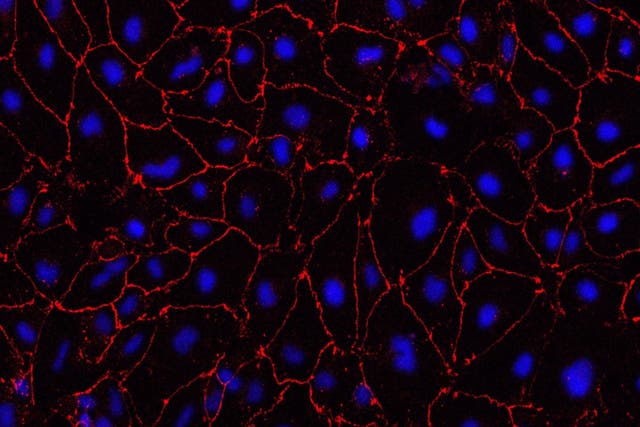 ‘Lab-grown small blood vessels indicate treatment for major cause of stroke’ (Alessandra Granata/University of Cambridge)