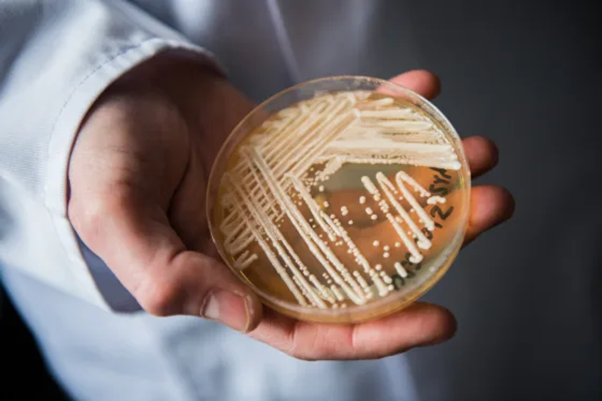 Warning as fungus 'superbug' cases at highest levels in Nevada - Vimarsana News