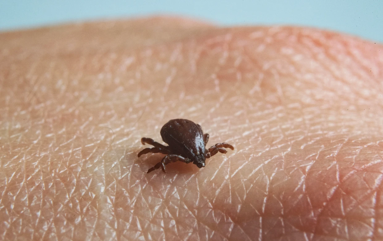 Different species of ticks can spread Rocky Mountain spotted fever