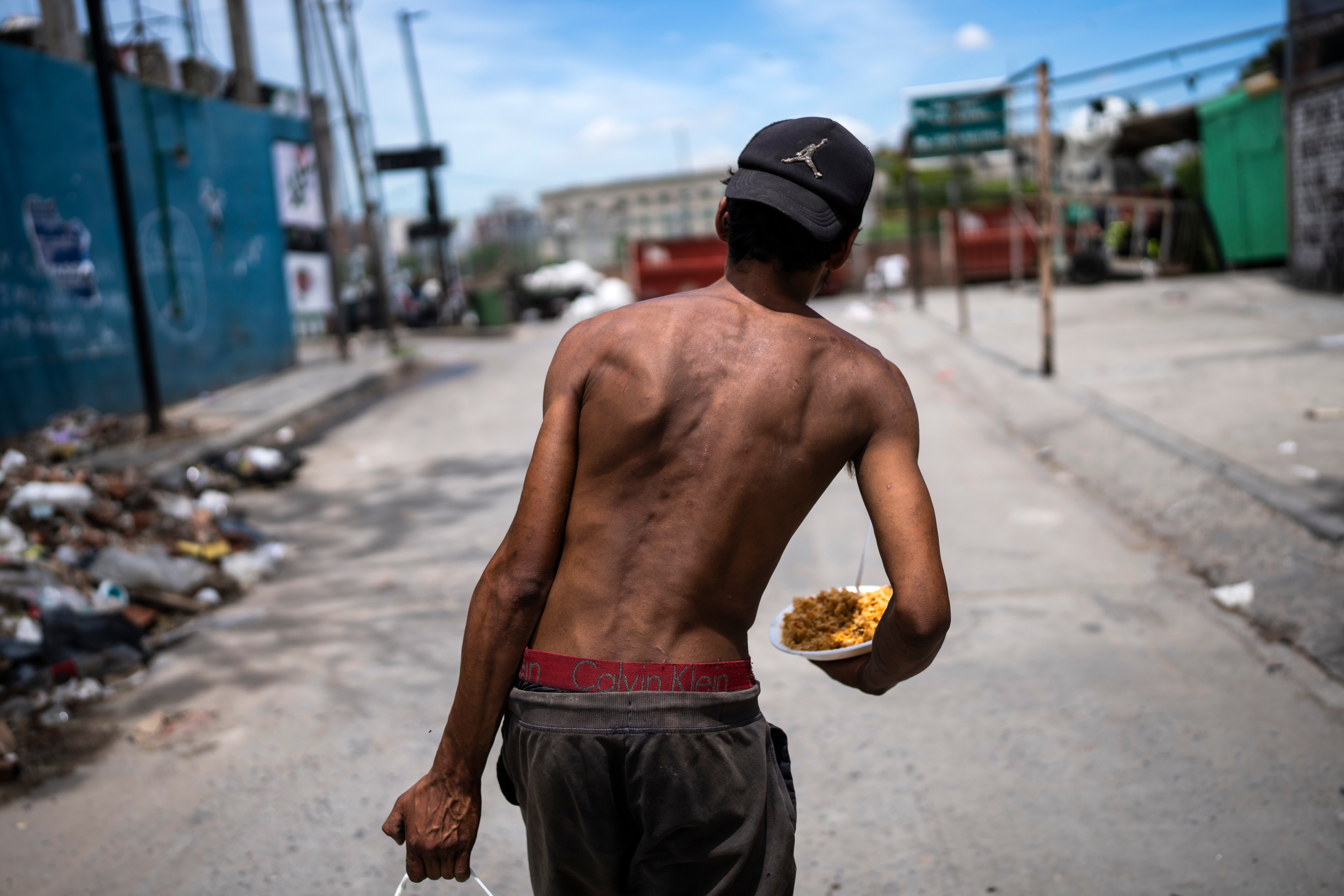 APTOPIX ARGENTINA-AJUSTE