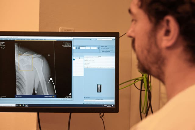<p>A doctor looks at an X-ray on a screen, helped by artificial intelligence for medical imaging which indicates possible bone fractures and dislocations at the university hospital in Rennes, western France on September 26, 2023</p>