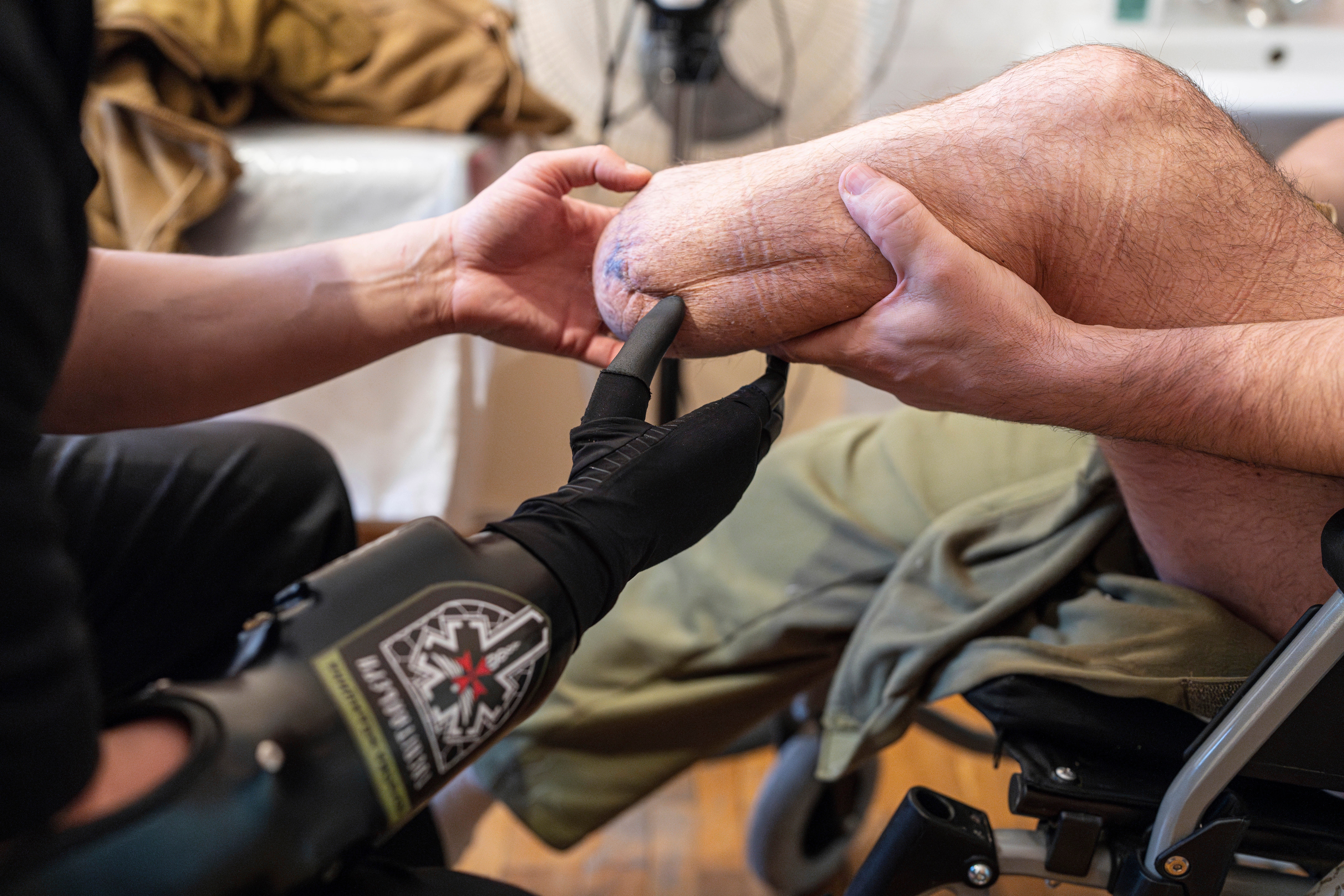 Russia Ukraine Bionic Limbs