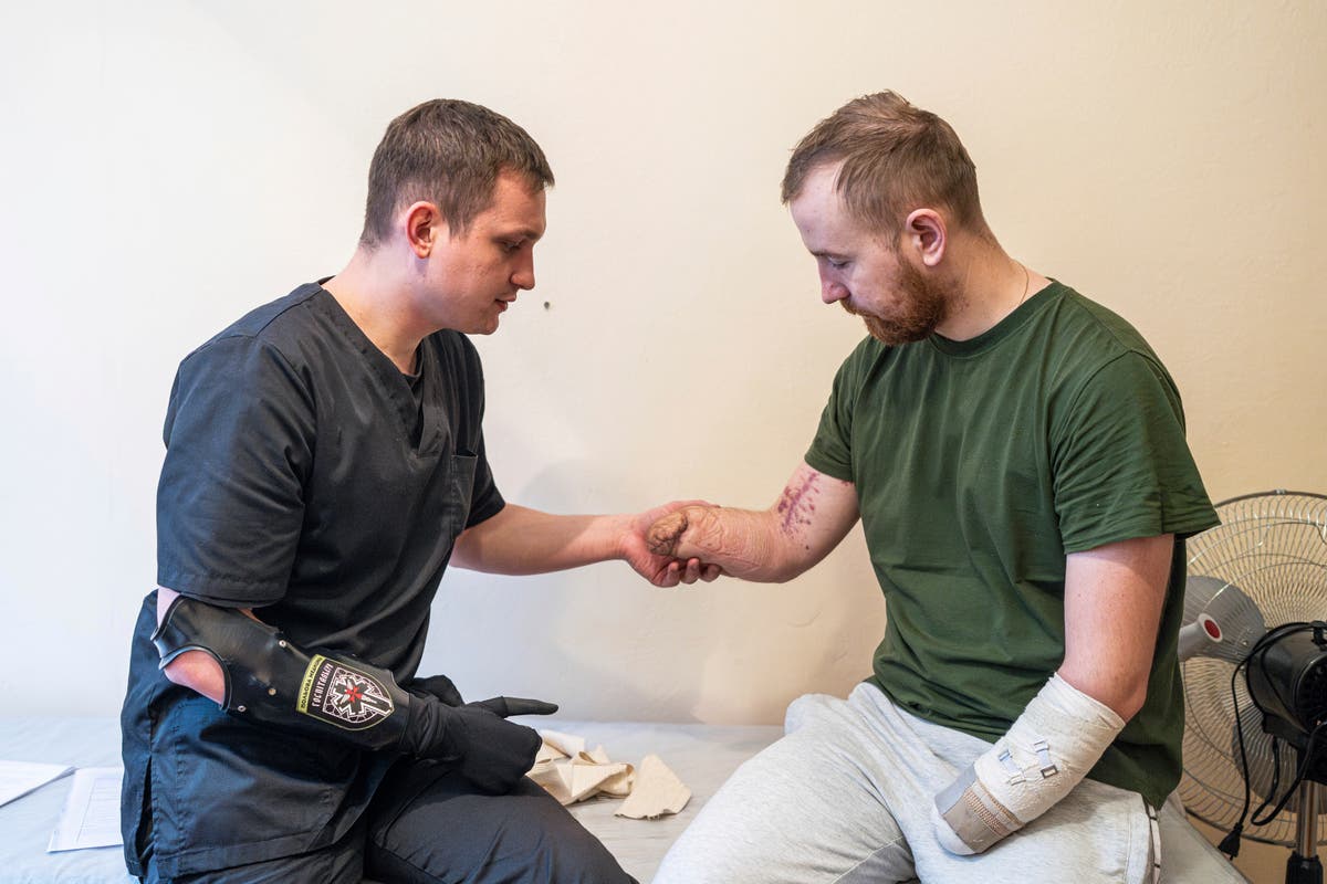 Войната им отне крайниците. Сега бионичните протези дават сила на ранените украински войници