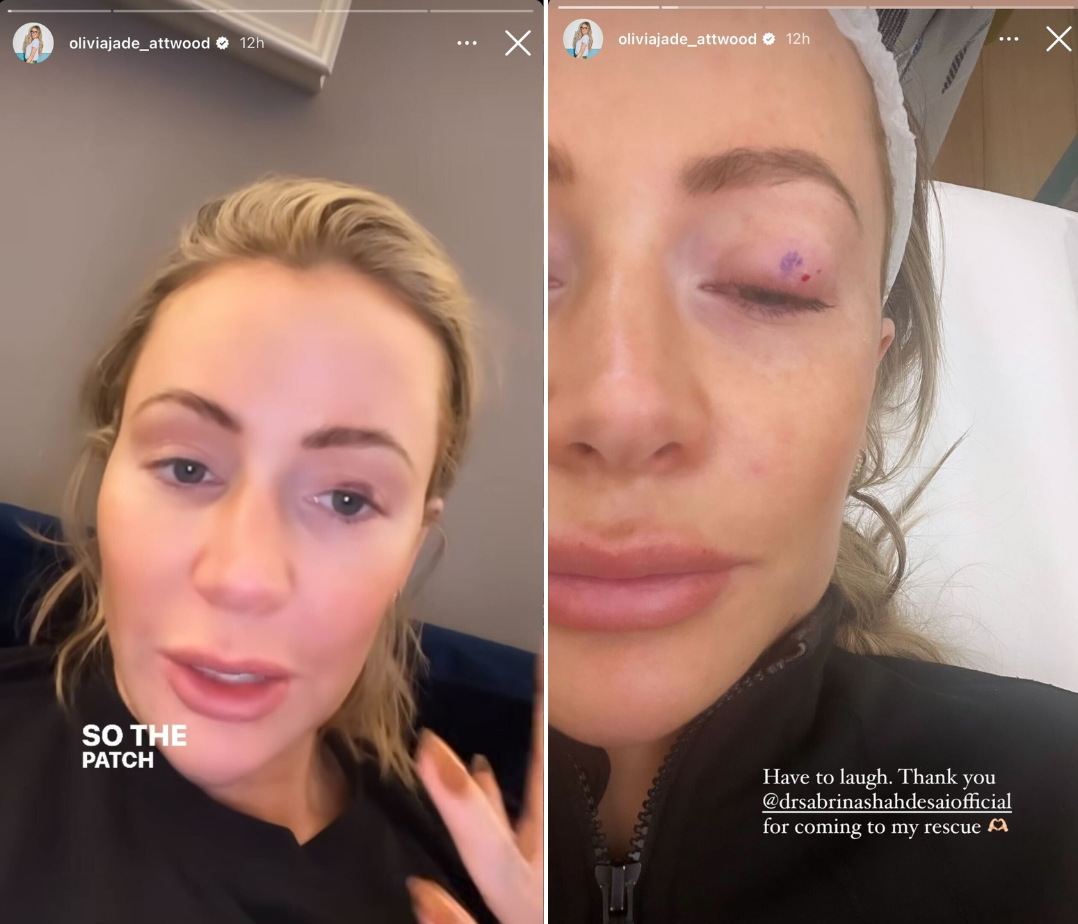 Olivia Attwood shares an update with fans on Instagram