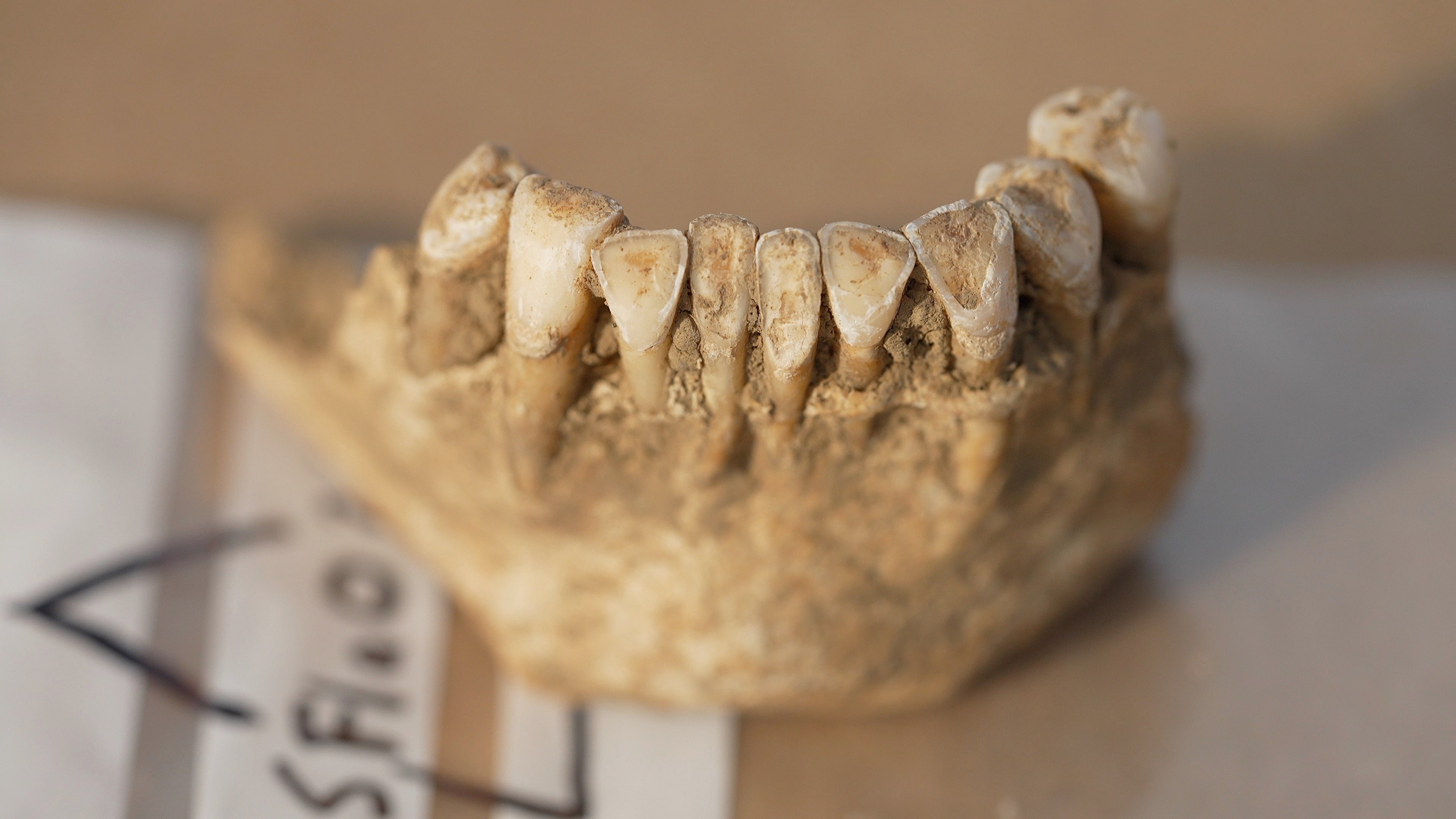The front teeth from one of the skeletons are very worn