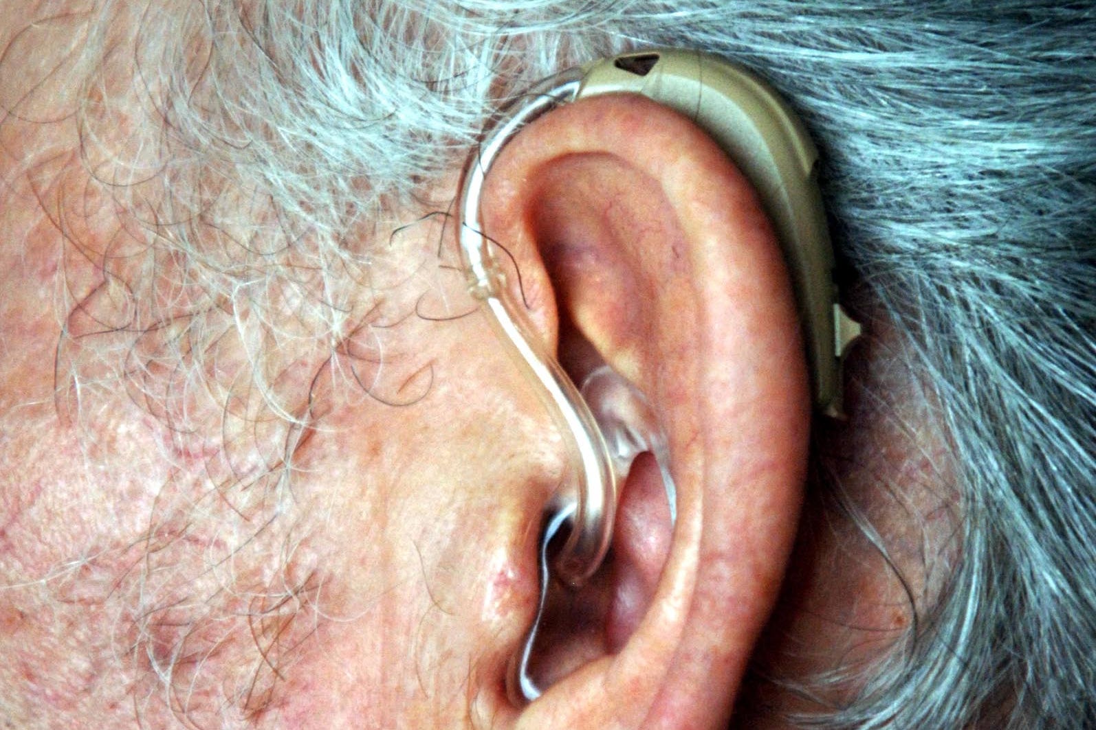 A Danish study suggests people with hearing loss who do not use hearing aids could have a higher risk of developing dementia (PA)