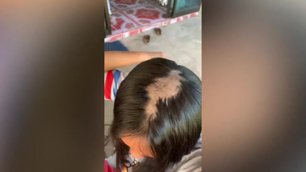 Thai women’s hair falls out after using popular TikTok hair cream