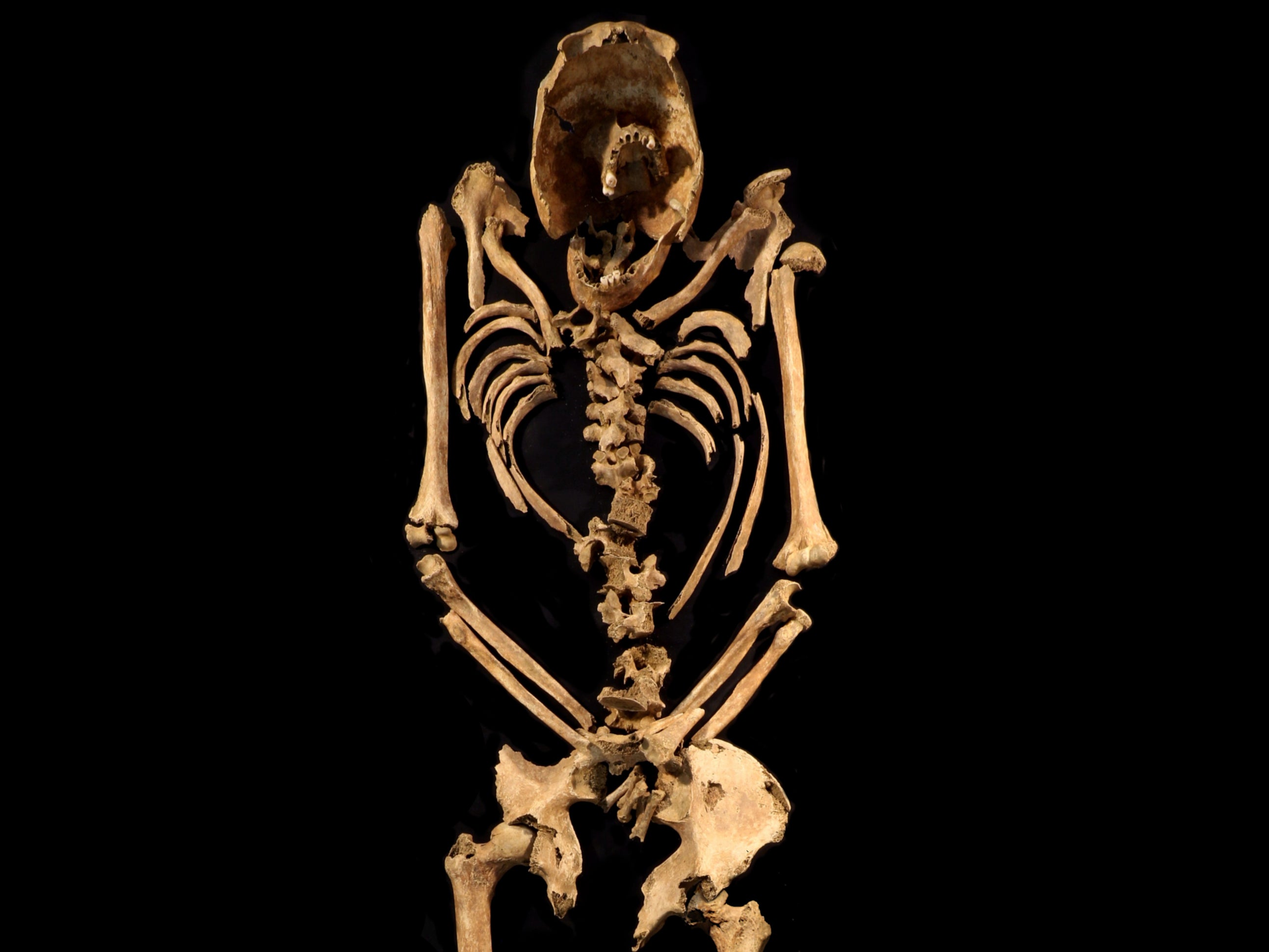 The remains of the man’s skeleton found in Fenstanton in Cambridgeshire
