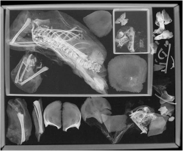 <p>Plain film radiograph of mummified fetus</p>