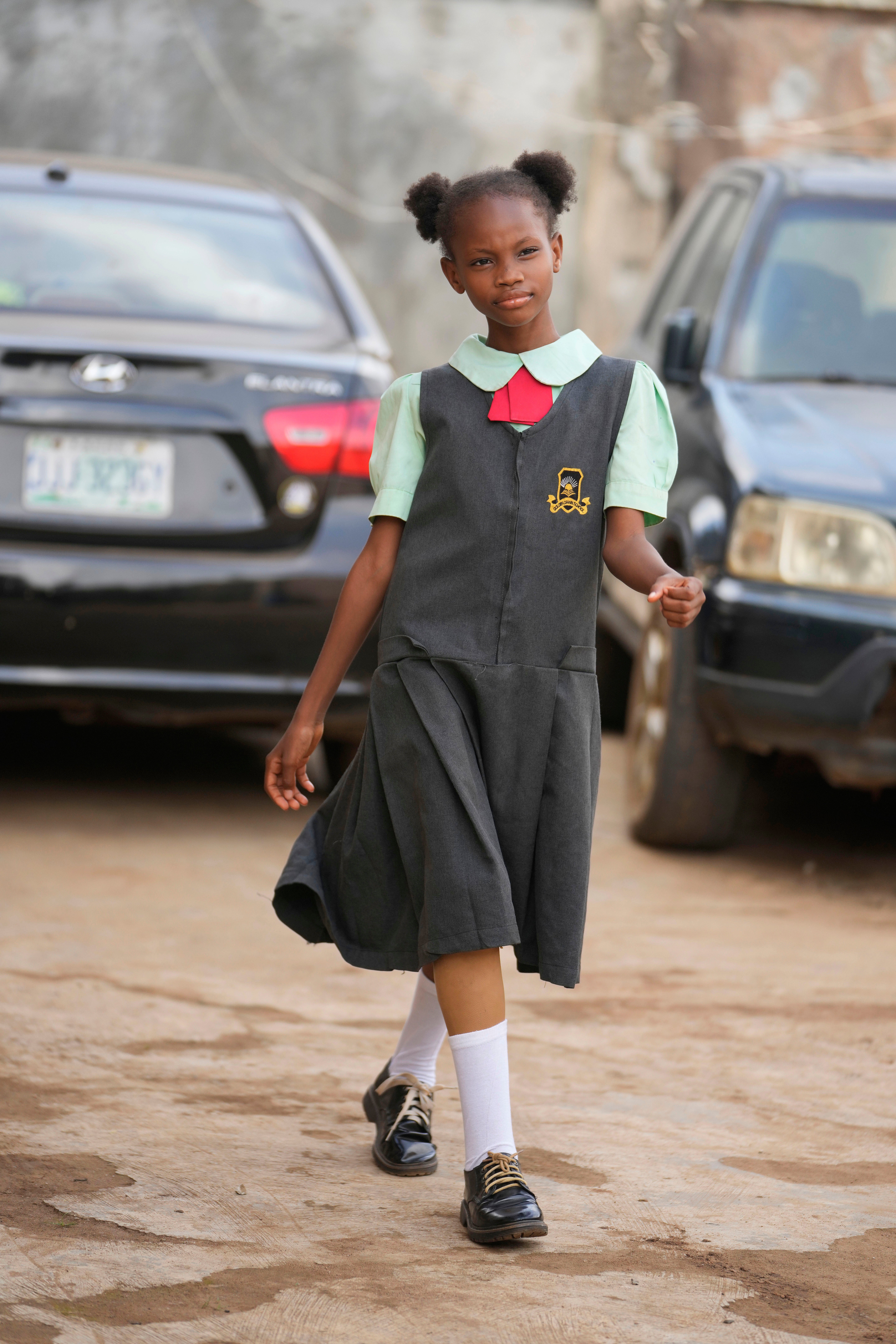 Nigeria Child Amputees