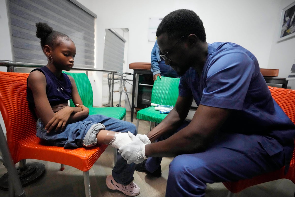 Nigerian group provides hundreds of prosthetic limbs to amputee children  thanks to crowdfunding | The Independent